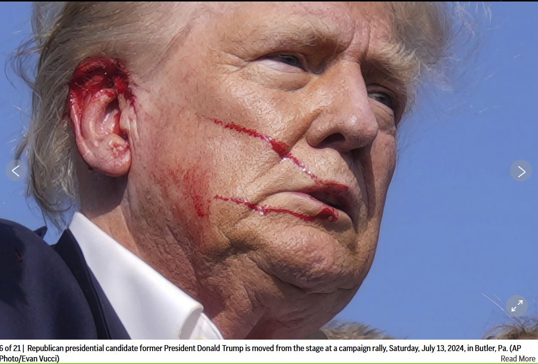 Somehow, President Donald J. Trump, 'Being Shot In The Ear' Manages To Keep His Shirt Collar 'Pristine', 'Undefiled'--Virtually No Blood In His Hair, None On His Neck, None On His Right Sleeve--All Odds Were 'In His Favor' That Day, 13JUL24.jpg